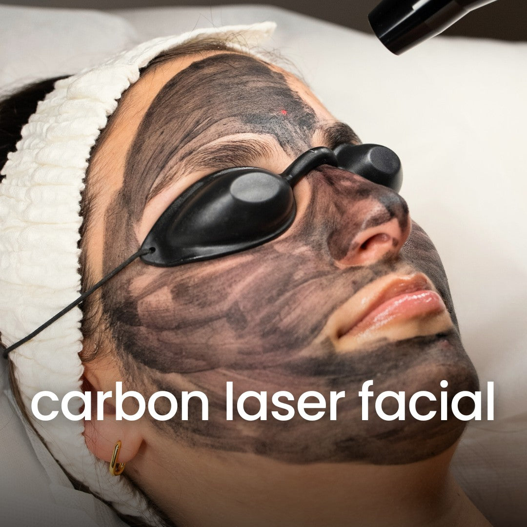 Carbon Laser Facial - also known as China Doll Facial. Book online, Prahran Melbourne. Bodyvision Clinic.