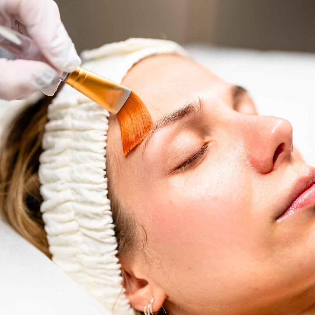 Skin peels, masks and facials at Bodyvision Clinic Prahran Melbourne